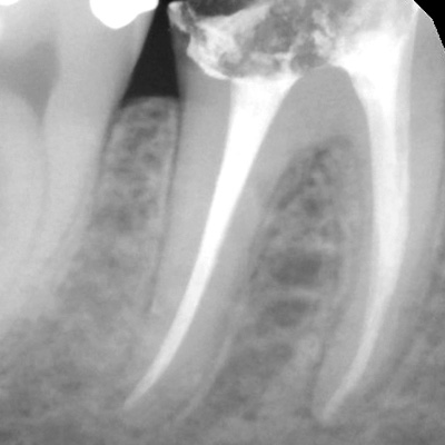 Occlusion Update