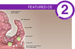 CE - Featured Image
