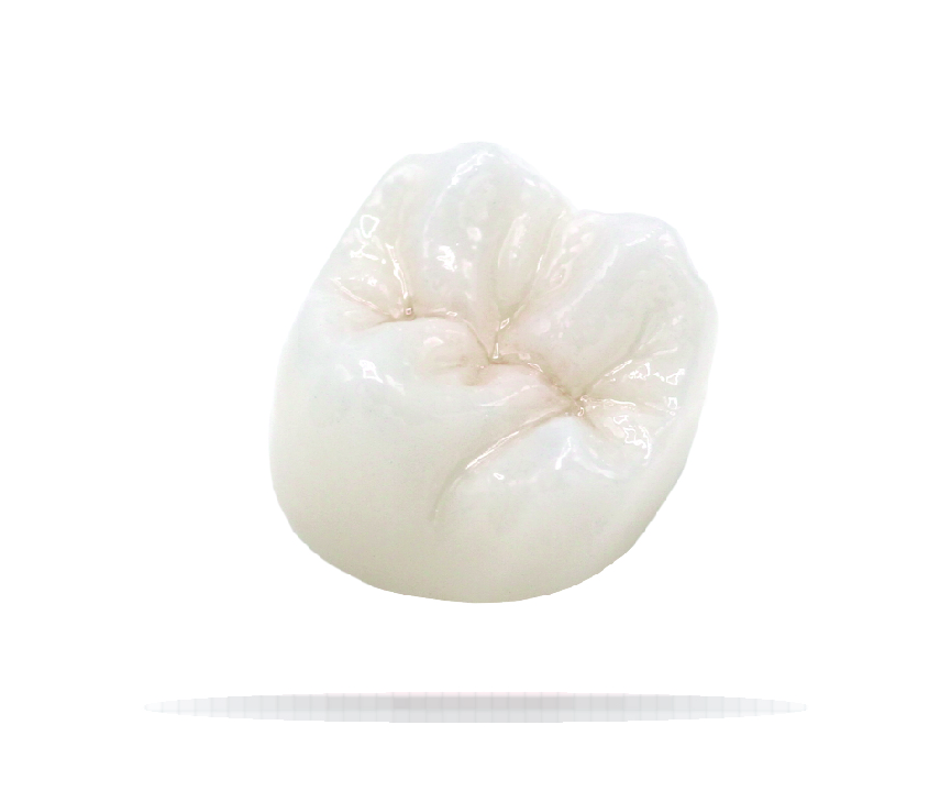 Full Contour Zirconia