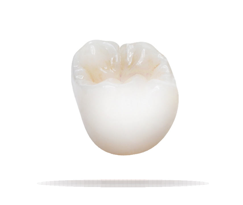 Full Contour Zirconia IOS